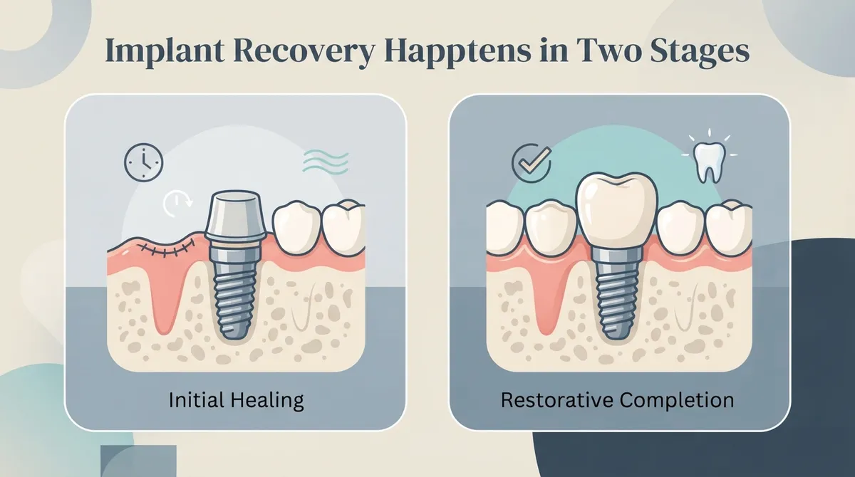 11 Facts on How Long Implant Recovery Really Takes how long is implant recovery