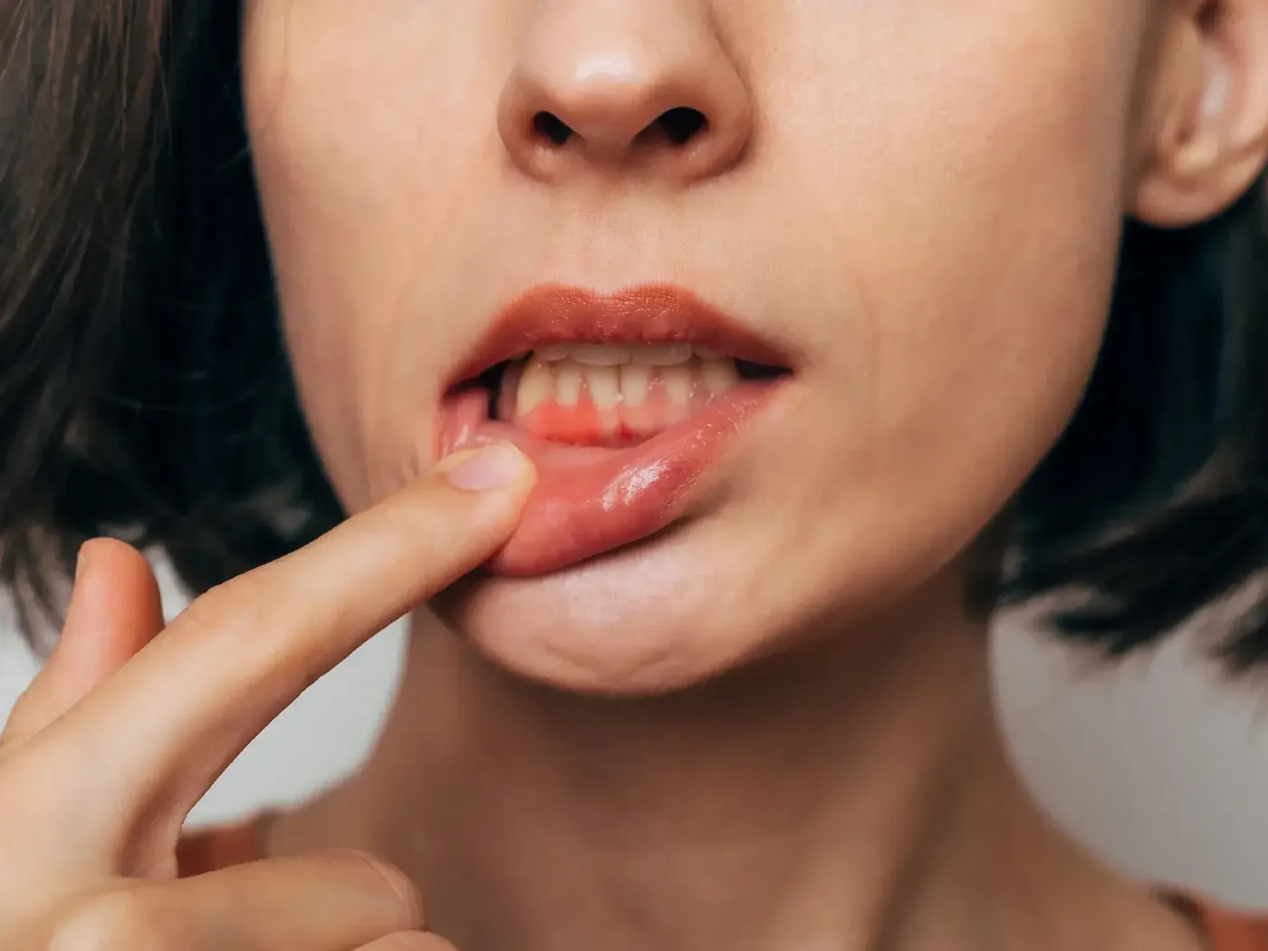 Patient discussing gum health with the dental team
